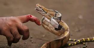 لدغة أفعى تُرسل شابًا من دوار إعشيران إلى قسم الإنعاش