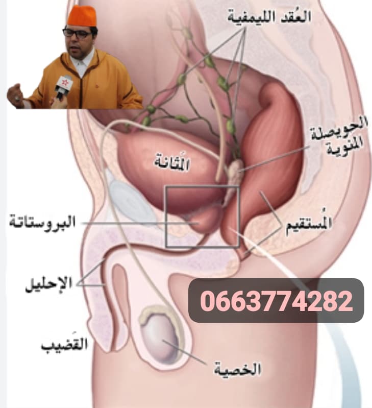 التهاب البروستات.. أسبابه و علاجه