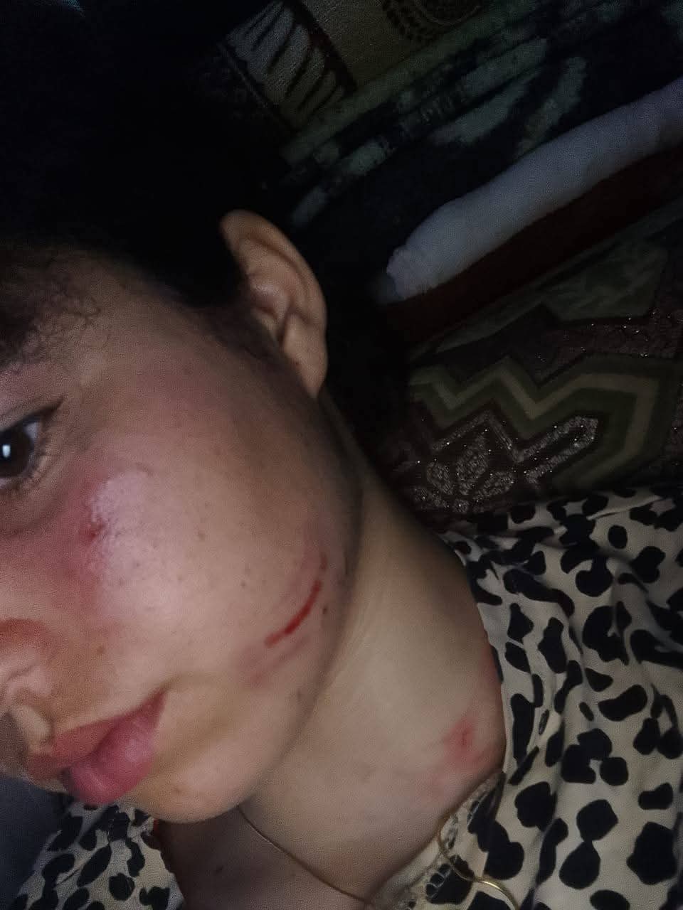 اعتداء شنيع على تلميذة قاصر داخل إعدادية مولاي رشيد بتازة يثير موجة استياء واسعة.